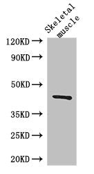 Western Blot | Positive WB detected in: Mouse skeletal muscle tissue | All lanes: SPHK1 antibody at 3μg/ml | Secondary | Goat polyclonal to rabbit IgG at 1/50000 dilution | Predicted band size: 43, 52, 44 kDa | Observed band size: 43 kDaRabbit anti-Human SPHK1 Polyclonal Antibody