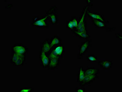 Immunofluorescent analysis of Hela cells using SPINK1 Antibody at dilution of 1:100 and Alexa Fluor 488-congugated AffiniPure Goat Anti-Rabbit IgG(H+L)Rabbit anti-Human SPINK1 Polyclonal Antibody