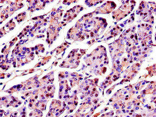 Immunohistochemistry of paraffin-embedded human pancreatic tissue using the antibody at dilution of 1:100Rabbit anti-Human SPINK1 Polyclonal Antibody