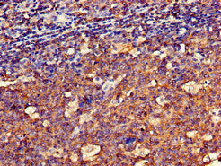 Immunohistochemistry of paraffin-embedded human tonsil tissue using SPRR1A Antibody at dilution of 1:100Rabbit anti-Human SPRR1A Polyclonal Antibody
