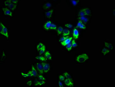 Immunofluorescence staining of PC-3 cells with the antibody at 1:266, counter-stained with DAPI. The cells were fixed in 4% formaldehyde, permeabilized using 0.2% Triton X-100 and blocked in 10% normal Goat Serum. The cells were then incubated with the antibody overnight at 4°C. The secondary antibody was Alexa Fluor 488-congugated AffiniPure Goat Anti-Rabbit IgG(H+L).Rabbit anti-Human SPRY1 Polyclonal Antibody