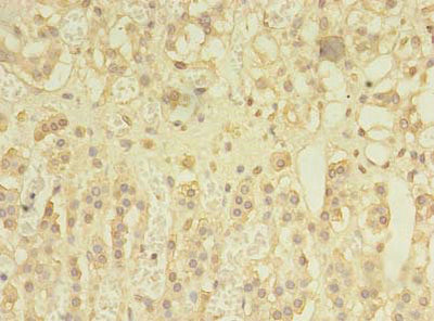 Immunohistochemistry of paraffin-embedded human adrenal gland tissue using SPRY1 Antibody at dilution of 1:100Rabbit anti-Human SPRY1 Polyclonal Antibody