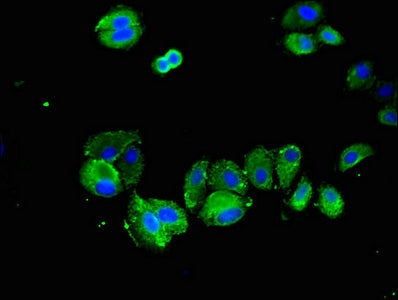 Immunofluorescent analysis of HepG2 cells using SPRY2 Antibody at dilution of 1:100 and Alexa Fluor 488-congugated AffiniPure Goat Anti-Rabbit IgG(H+L)Rabbit anti-Human SPRY2 Polyclonal Antibody