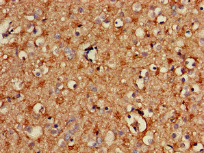 Immunohistochemistry of paraffin-embedded human brain tissue using SPRY2 Antibody at dilution of 1:100Rabbit anti-Human SPRY2 Polyclonal Antibody