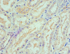 Immunohistochemistry of paraffin-embedded human kidney tissue using SPTLC1 Antibody at dilution of 1:100Rabbit anti-Human SPTLC1 Polyclonal Antibody