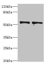 Western blot  | All lanes: SPTLC1 antibody at 8µg/ml  | Lane 1: 293T whole cell lysate  | Lane 2: MCF-7 whole cell lysate  | Secondary  | Goat polyclonal to rabbit at 1/10000 dilution  | Predicted band size: 53, 17 kDa  | Observed band size: 53 kDaRabbit anti-Human SPTLC1 Polyclonal Antibody