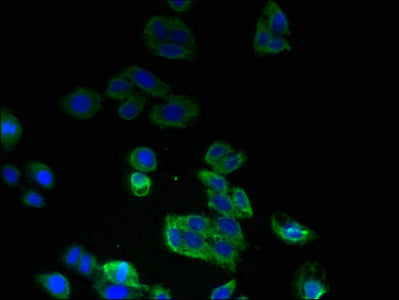 Immunofluorescent analysis of HepG2 cells using SPTLC2 Antibody at dilution of 1:100 and Alexa Fluor 488-congugated AffiniPure Goat Anti-Rabbit IgG(H+L)