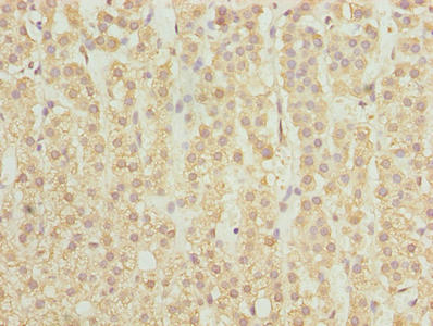 Immunohistochemistry of paraffin-embedded human adrenal gland tissue using SPTLC2 Antibody at dilution of 1:100