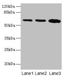 Western blot  | All lanes: SPTLC2 antibody at 12µg/ml  | Lane 1: HepG2 whole cell lysate  | Lane 2: A549 whole cell lysate  | Lane 3: HT29 whole cell lysate  | Secondary  | Goat polyclonal to rabbit IgG at 1/10000 dilution  | Predicted band size: 63 kDa  | Observed band size: 63 kDa