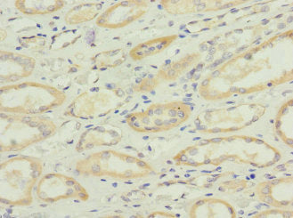 Immunohistochemistry of paraffin-embedded human kidney tissue using SQOR Antibody at dilution of 1:100Rabbit anti-Human SQOR Polyclonal Antibody