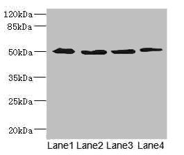 Western blot | All lanes: SQRDL antibody at 4.67μg/ml | Lane 1: A549 whole cell lysate | Lane 2: A431 whole cell lysate | Lane 3: Hela whole cell lysate | Lane 4: HepG2 whole cell lysate | Secondary | Goat polyclonal to rabbit IgG at 1/10000 dilution | Predicted band size: 50 kDa | Observed band size: 50 kDaRabbit anti-Human SQOR Polyclonal Antibody
