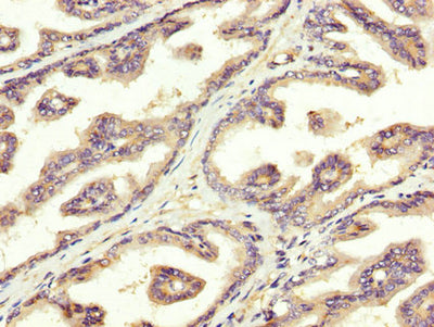 IHC image of SREBF1 Antibody diluted at 1:300 and staining in paraffin-embedded human prostate tissue performed on a Leica BondTM system. After dewaxing and hydration, antigen retrieval was mediated by high pressure in a citrate buffer (pH 6.0). Section was blocked with 10% normal goat serum 30min at RT. Then primary antibody (1% BSA) was incubated at 4°C overnight. The primary is detected by a biotinylated secondary antibody and visualized using an HRP conjugated SP system.Rabbit anti-Human SREBF1 Polyclonal Antibody