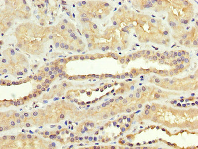 IHC image of SREBF1 Antibody diluted at 1:300 and staining in paraffin-embedded human kidney tissue performed on a Leica BondTM system. After dewaxing and hydration, antigen retrieval was mediated by high pressure in a citrate buffer (pH 6.0). Section was blocked with 10% normal goat serum 30min at RT. Then primary antibody (1% BSA) was incubated at 4°C overnight. The primary is detected by a biotinylated secondary antibody and visualized using an HRP conjugated SP system.Rabbit anti-Human SREBF1 Polyclonal Antibody