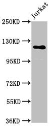 Western Blot  | Positive WB detected in: Jurkat whole cell lysate  | All lanes: SREBF1 antibody at 5.7µg/ml  | Secondary  | Goat polyclonal to rabbit IgG at 1/50000 dilution  | Predicted band size: 122, 114, 112, 125, 49, 46 kDa  | Observed band size: 122 kDaRabbit anti-Human SREBF1 Polyclonal Antibody