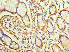 Immunohistochemistry of paraffin-embedded human small intestine tissue using SRI Antibody at dilution of 1:100Rabbit anti-Human SRI Polyclonal Antibody