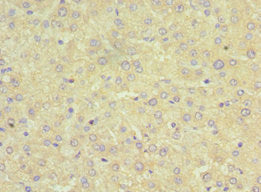 Immunohistochemistry of paraffin-embedded human liver tissue using SRI Antibody at dilution of 1:100Rabbit anti-Human SRI Polyclonal Antibody
