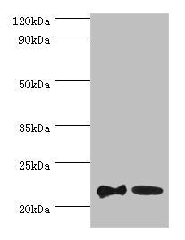 Western blot  | All lanes: SRI antibody at 2µg/ml  | Lane 1: HepG2 whole cell lysate  | Lane 2: Hela whole cell lysate  | Secondary  | Goat polyclonal to rabbit at 1/10000 dilution  | Predicted band size: 22, 21 kDa  | Observed band size: 22 kDaRabbit anti-Human SRI Polyclonal Antibody