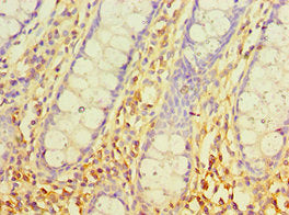 Immunohistochemistry of paraffin-embedded human colon tissue using SRM Antibody at dilution of 1:100Rabbit anti-Human SRM Polyclonal Antibody