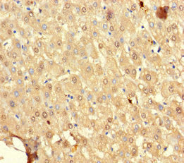 Immunohistochemistry of paraffin-embedded human liver tissue using SRP19 Antibody at dilution of 1:100Rabbit anti-Human SRP19 Polyclonal Antibody