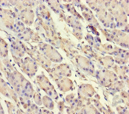 Immunohistochemistry of paraffin-embedded human pancreatic tissue using SRP19 Antibody at dilution of 1:100Rabbit anti-Human SRP19 Polyclonal Antibody