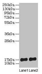 Western blot  | All lanes: SRP19 antibody at 2µg/ml  | Lane 1: Jurkat whole cell lysate  | Lane 2: Hela whole cell lysate  | Secondary  | Goat polyclonal to rabbit lgG at 1/15000 dilution  | Predicted band size: 17, 13, 9 kDa  | Observed band size: 17 kDaRabbit anti-Human SRP19 Polyclonal Antibody
