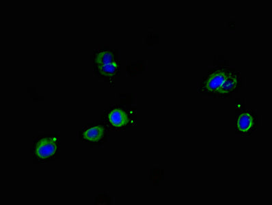 Immunofluorescent analysis of Hela cells using SRP19 Antibody at dilution of 1:100 and Alexa Fluor 488-congugated AffiniPure Goat Anti-Rabbit IgG(H+L)Rabbit anti-Human SRP19 Polyclonal Antibody