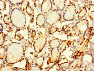 Immunohistochemistry of paraffin-embedded human thyroid tissue using SRP19 Antibody at dilution of 1:100Rabbit anti-Human SRP19 Polyclonal Antibody
