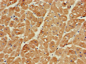 Immunohistochemistry of paraffin-embedded human heart tissue using SRR Antibody at dilution of 1:100Rabbit anti-Human SRR Polyclonal Antibody
