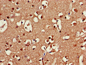 Immunohistochemistry of paraffin-embedded human brain tissue using SRR Antibody at dilution of 1:100Rabbit anti-Human SRR Polyclonal Antibody