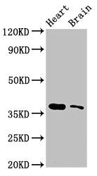 Western Blot | Positive WB detected in: Mouse heart tissue, Mouse brain tissue | All lanes: SRR antibody at 3μg/ml | Secondary | Goat polyclonal to rabbit IgG at 1/50000 dilution | Predicted band size: 37 kDa | Observed band size: 37 kDaRabbit anti-Human SRR Polyclonal Antibody