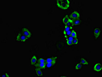 Immunofluorescent analysis of PC-3 cells using HPCAL1 Antibody at dilution of 1:100 and Alexa Fluor 488-congugated AffiniPure Goat Anti-Rabbit IgG(H+L)Rabbit anti-Human HPCAL1 Polyclonal Antibody