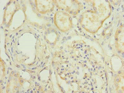 Immunohistochemistry of paraffin-embedded human kidney tissue using the antibody at dilution of 1:100Rabbit anti-Human HPCAL1 Polyclonal Antibody