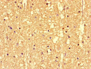 Immunohistochemistry of paraffin-embedded human brain tissue using SS18L1 Antibody at dilution of 1:100Rabbit anti-Human SS18L1 Polyclonal Antibody
