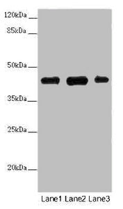 Western blot | All lanes: SS18L1 antibody at 2 μg/ml | Lane 1: Mouse kidney tissue | Lane 2: Mouse lung tissue | Lane 3: Mouse spleen tissue | Secondary | Goat polyclonal to rabbit IgG at 1/10000 dilution | Predicted band size: 43, 41, 34, 30, 44 kDa | Observed band size: 43 kDaRabbit anti-Human SS18L1 Polyclonal Antibody