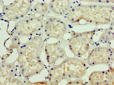Immunohistochemistry of paraffin-embedded human kidney tissue using SSSCA1 Antibody at dilution of 1:100Rabbit anti-Human SSSCA1 Polyclonal Antibody