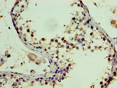 Immunohistochemistry of paraffin-embedded human testis tissue using SSSCA1 Antibody at dilution of 1:100Rabbit anti-Human SSSCA1 Polyclonal Antibody