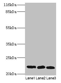Western blot  | All lanes: SSSCA1 antibody at 2µg/ml  | Lane 1: A549 whole cell lysate  | Lane 2: MCF-7 whole cell lysate  | Lane 3: 293T whole cell lysate  | Secondary  | Goat polyclonal to rabbit IgG at 1/10000 dilution  | Predicted band size: 22 kDa  | Observed band size: 22 kDaRabbit anti-Human SSSCA1 Polyclonal Antibody