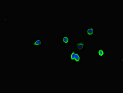 Immunofluorescent analysis of HepG2 cells using SSTR2 Antibody at dilution of 1:100 and Alexa Fluor 488-congugated AffiniPure Goat Anti-Rabbit IgG(H+L)Rabbit anti-Human SSTR2 Polyclonal Antibody