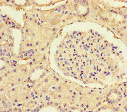 Immunohistochemistry of paraffin-embedded human kidney tissue using SSTR2 Antibody at dilution of 1:100Rabbit anti-Human SSTR2 Polyclonal Antibody
