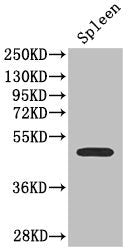 Western Blot | Positive WB detected in: Mouse spleen tissue | All lanes: SSTR2 antibody at 2.7μg/ml | Secondary | Goat polyclonal to rabbit IgG at 1/50000 dilution | Predicted band size: 42, 41 kDa | Observed band size: 42 kDaRabbit anti-Human SSTR2 Polyclonal Antibody
