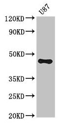 Western Blot  | Positive WB detected in: U87 whole cell lysate  | All lanes: ST8SIA5 antibody at 3.5µg/ml  | Secondary  | Goat polyclonal to rabbit IgG at 1/50000 dilution  | Predicted band size: 44, 48 kDa  | Observed band size: 44 kDaRabbit anti-Human ST8SIA5 Polyclonal Antibody