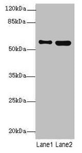 Western blot  | All lanes: STAM2 antibody at 4.09µg/ml  | Lane 1: 293T whole cell lysate  | Lane 2: Hela whole cell lysate  | Secondary  | Goat polyclonal to rabbit IgG at 1/10000 dilution  | Predicted band size: 59, 39 kDa  | Observed band size: 59 kDaRabbit anti-Human STAM2 Polyclonal Antibody