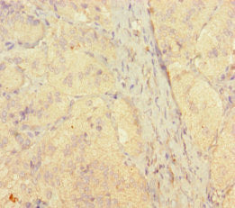 Immunohistochemistry of paraffin-embedded human adrenal gland tissue using STAMBP Antibody at dilution of 1:100Rabbit anti-Human STAMBP Polyclonal Antibody