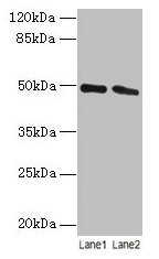 Western blot  | All lanes: STAMBP antibody at 12µg/ml  | Lane 1: Jurkat whole cell lysate  | Lane 2: Hela whole cell lysate  | Secondary  | Goat polyclonal to rabbit IgG at 1/10000 dilution  | Predicted band size: 49, 40 kDa  | Observed band size: 49 kDaRabbit anti-Human STAMBP Polyclonal Antibody
