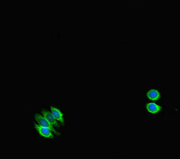 Immunofluorescent analysis of HepG2 cells using STAT1 Antibody at dilution of 1:100 and Alexa Fluor 488-congugated AffiniPure Goat Anti-Rabbit IgG(H+L)Rabbit anti-Human STAT1 Polyclonal Antibody