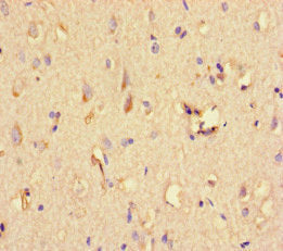 Immunohistochemistry of paraffin-embedded human brain tissue using STAT1 Antibody at dilution of 1:100Rabbit anti-Human STAT1 Polyclonal Antibody