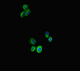 Immunofluorescent analysis of HepG2 cells using STAT3 Antibody at dilution of 1:100 and Alexa Fluor 488-congugated AffiniPure Goat Anti-Rabbit IgG(H+L)Rabbit anti-Human STAT3 Polyclonal Antibody