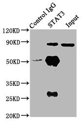 Immunoprecipitating STAT3 in Hela whole cell lysate | Lane 1: Rabbit control IgG (1μg) instead of STAT3 Antibody in Hela whole cell lysate. | For western blotting, a HRP-conjugated Protein G antibody was used as the secondary antibody (1/2000) | Lane 2: STAT3 Antibody (6μg) + Hela whole cell lysate (500μg) | Lane 3: Hela whole cell lysate (10μg)Rabbit anti-Human STAT3 Polyclonal Antibody