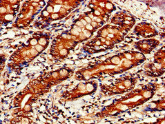 Immunohistochemistry of paraffin-embedded human small intestine tissue using STAT4 Antibody at dilution of 1:100Rabbit anti-Human STAT4 Polyclonal Antibody