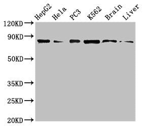 Western Blot  | Positive WB detected in: HepG2 whole cell lysate, Hela whole cell lysate, PC-3 whole cell lysate, K562 whole cell lyaste, Mouse brain tissue, Rat liver tissue  | All lanes: STAT4 antibody at 1µg/ml  | Secondary  | Goat polyclonal to rabbit IgG at 1/50000 dilution  | Predicted band size: 86 kDa  | Observed band size: 86 kDaRabbit anti-Human STAT4 Polyclonal Antibody